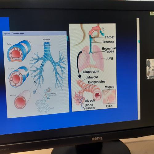 Computermonitor mit Bild des Atmungssystems